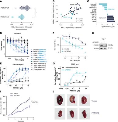PBRM1 loss is associated with increased sensitivity to MCL1 and CDK9 inhibition in clear cell renal cancer